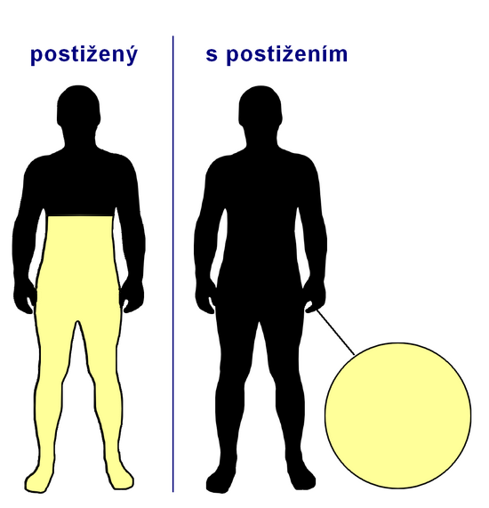 [http://zivot.poradna.net/file/view/75-postizeny-ob   a-550-png]